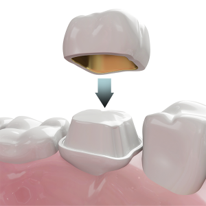 crowns_cap