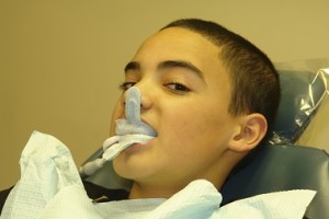 fluoride treatment