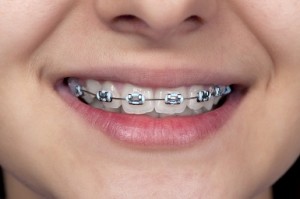 orthodontics_new
