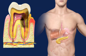periodontal_disease_and_diabetes